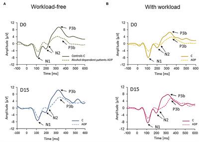 Persistence of Neuronal Alterations in Alcohol-Dependent Patients at Conclusion of the Gold Standard Withdrawal Treatment: Evidence From ERPs